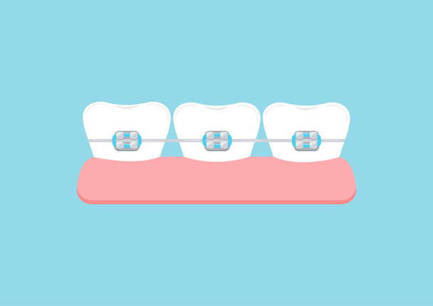 Teeth with dental braces in gym clip art illustration. - Vector, Imagen