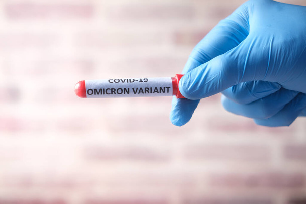  Omikron varyant korona virüsü kan testi tüpü.  - Fotoğraf, Görsel