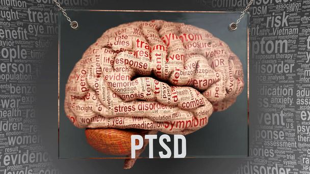 Ptsd anatomy - its causes and effects projected on a human brain revealing Ptsd complexity and relation to human mind. Concept art, 3d illustration - Photo, Image