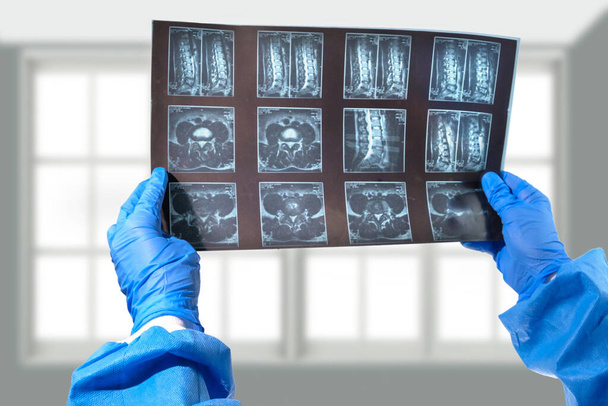 A doctor hand with blue glove holding and analyzes spine radiography X-ray  - Zdjęcie, obraz