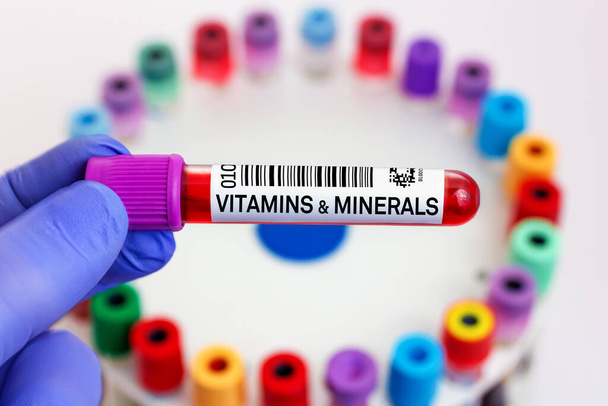 Blutprobe des Patienten auf Vitamine und Mineralstoffe im Labor. Arzt mit Blutröhrchen für Vitamin- & Mineralstofftest im Labor - Foto, Bild
