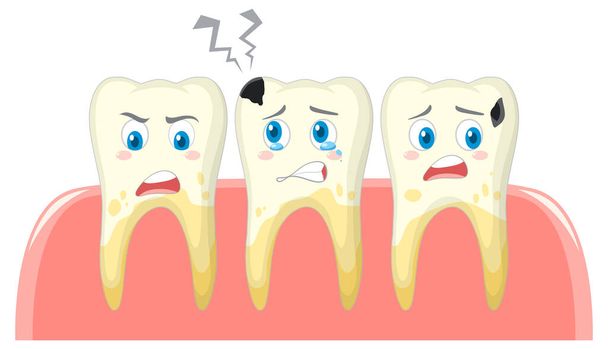 Beyaz arkaplan illüstrasyonunda diş ve farklı diş durumu - Vektör, Görsel