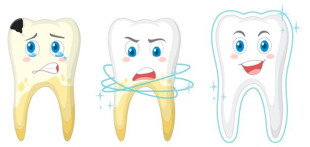 Beyaz arkaplan çiziminde farklı diş durumu - Vektör, Görsel