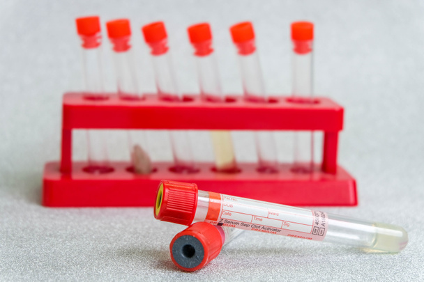 Медицинские вакуумные трубки с красной отметкой с биологическими образцами и лабораторный стенд с медицинскими трубками - Фото, изображение