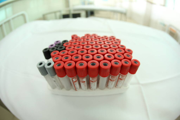 Krevní vyšetření lékařské trubky v nemocnici - Fotografie, Obrázek