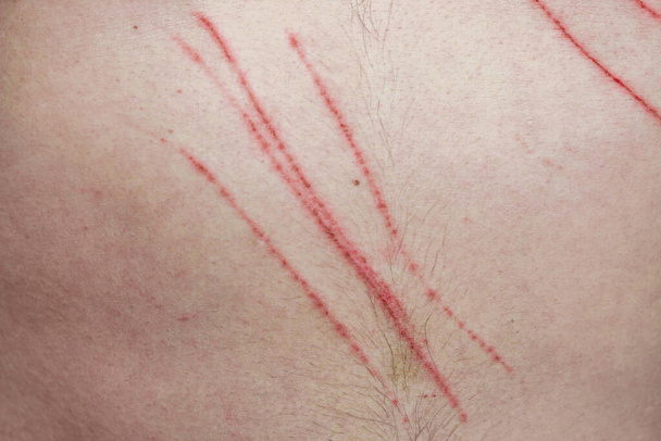 Riscos profundos de garras na pele de uma pessoa. - Foto, Imagem