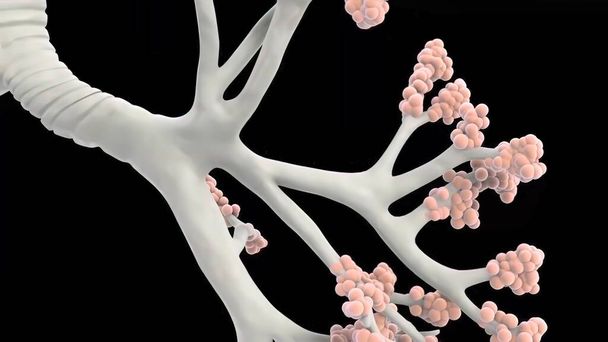 Alveolen sind die Luftsäcke am Ende des Atemwegsbaums der Lunge und sind lebenswichtig für die Atmung. - Foto, Bild