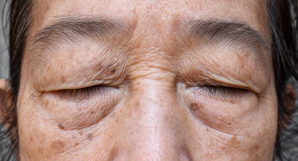Wrinkles around closed eye of Asian elder woman. Closeup view. - Photo, Image