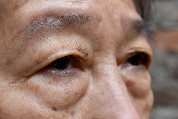 Prominente sacchetto di grasso sotto gli occhi della donna anziana asiatica. Vista da vicino. - Foto, immagini