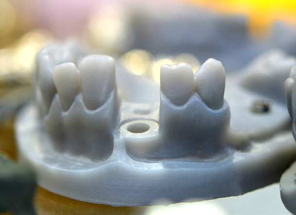 Modelo de mandíbula dobrável com dentes e furos para o pilar da coroa do implante impresso em uma impressora 3d
 - Foto, Imagem