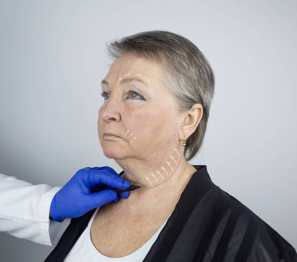 An elderly woman at the reception of a facial plastic surgeon. Consultation on the removal of age wrinkles on the face. The doctor shows what procedures he will do. Mimic wrinkles. Contour plastic - Photo, Image