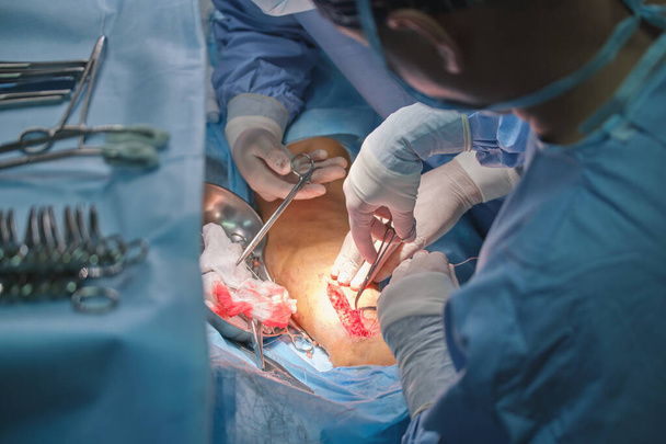Team of professional doctors operating a patient conducting open cut surgery in surgical room. Healthcare and medical intervention concept - Photo, Image