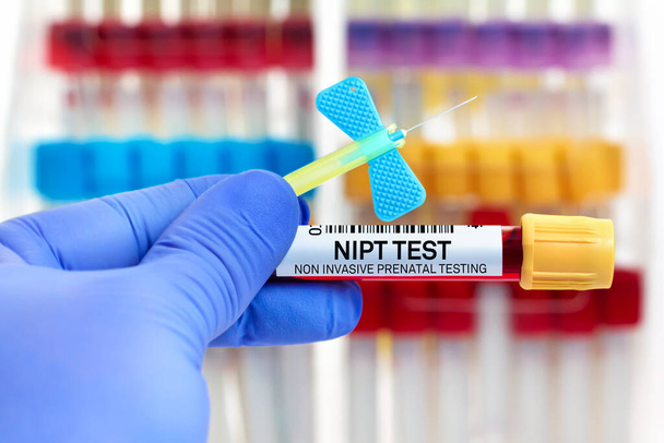 A beteg vérmintája nem invazív terhességi teszt NIPT-hez laboratóriumban. NIPT-hez szükséges vércsővel és katéterrel rendelkező orvos Nem invazív terhességi vizsgálat antenatális szűrővizsgálatra - Fotó, kép