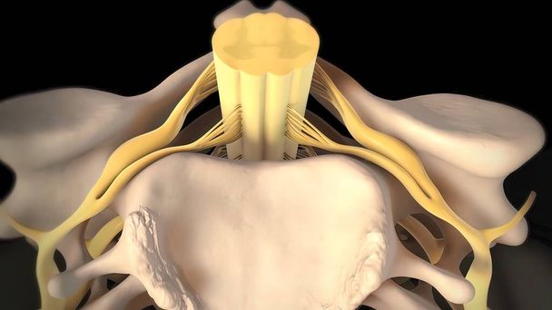 грыжа межпозвоночного диска является травмой амортизации и соединительной ткани между позвонками, как правило, вызванной чрезмерным напряжением или травмой позвоночника. 3D Render - Фото, изображение
