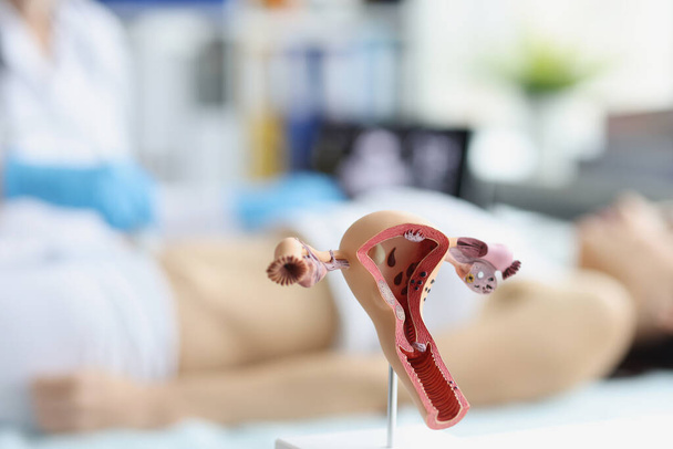 Anatominen malli naisten kohtu ja munasarjat, nainen ultraääni skannaus - Valokuva, kuva