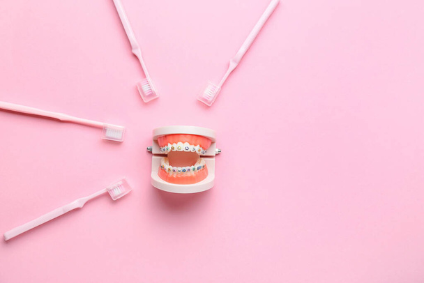 Модель челюсти с зубными скобками и зубными щетками на розовом фоне - Фото, изображение