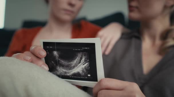 Elinde ultrason taraması ve arka planda iki kadın var. 8K 'da kırmızı helyum kamerayla çekildi.. - Video, Çekim