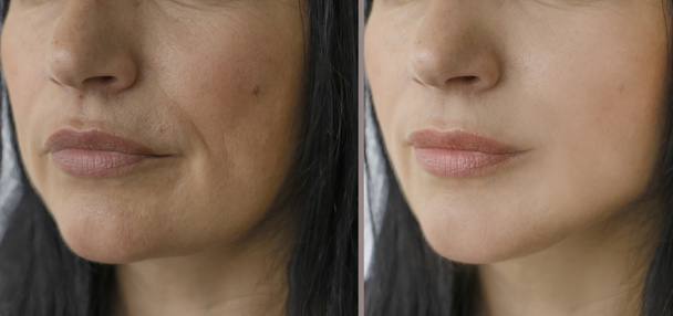 女性の顔のしわの前に、と後 - 写真・画像