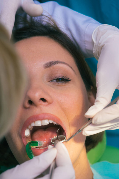 Primo piano esame dentale pulito sui denti di una donna in uno studio dentistico - Foto, immagini