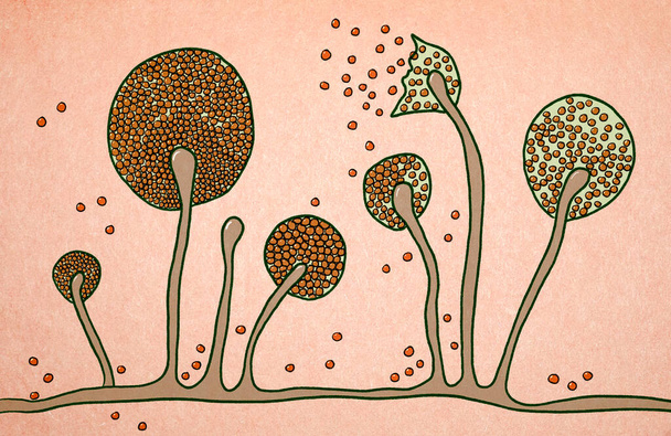 Структура мукорної форми, чорний гриб, жовтий гриб, ілюстрація. Опортуністичні гриби, які викликають слизові оболонки за участю шкіри, носових пазух, мозку та легенів. Ускладнення Ковіда-19
 - Фото, зображення