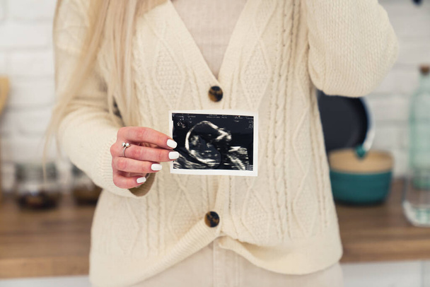Blond pregnant Caucasian woman in light clothes showing prenatal ultrasound screening to the camera selective focus  - Zdjęcie, obraz