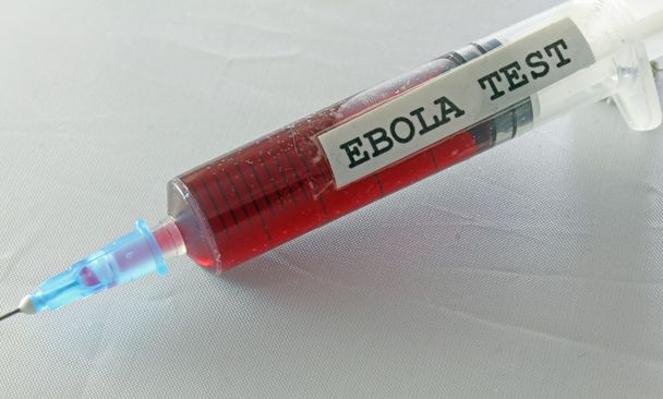 krev virem ebola v lékařské laboratorní krevní test - Fotografie, Obrázek