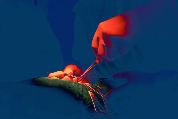 Un chirurgo professionista che esegue un intervento. con il colore dell'immagine che è arancione e blu - Foto, immagini