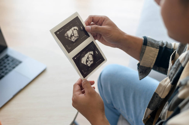 Young father holding ultrasound photo of newborn baby, maternity and family concept - Φωτογραφία, εικόνα