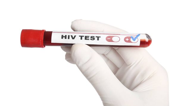 Scientist holding tube with blood sample and label HIV Test on white background, closeup - Foto, immagini
