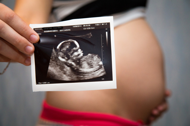 Schwangerer Magen - Foto, Bild