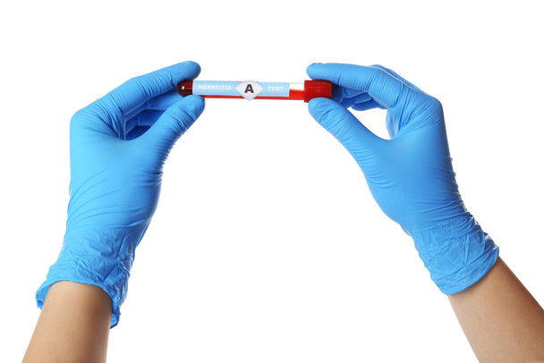 Scientist holding tube with blood sample and label Hepatitis A Test on white background, closeup - Fotoğraf, Görsel