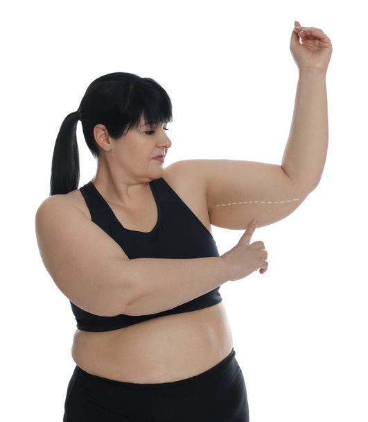 Obese woman with flabby arm on white background. Weight loss surgery - Φωτογραφία, εικόνα