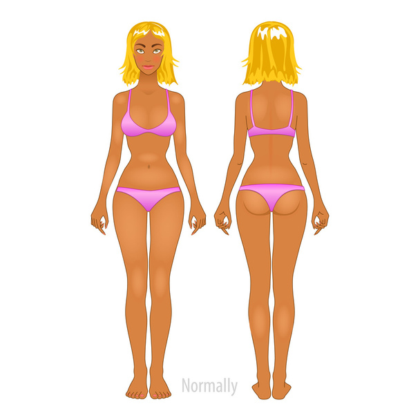 Mujer gorda y delgada, ilustración vectorial, normal, cuerpo anorexia
 - Vector, imagen