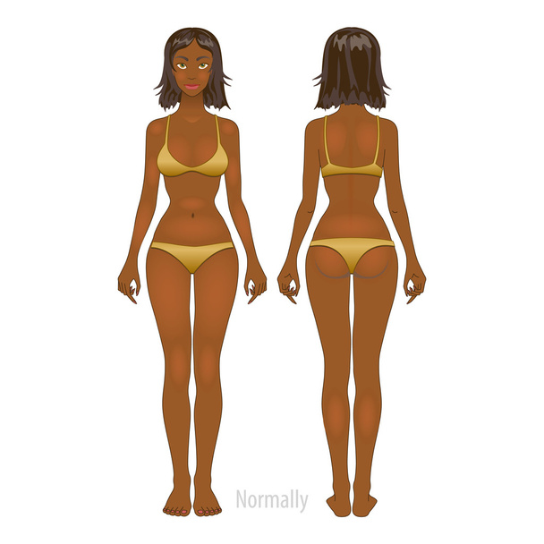 Fat and thin woman, vector illustration, normal, anorexia body - Διάνυσμα, εικόνα