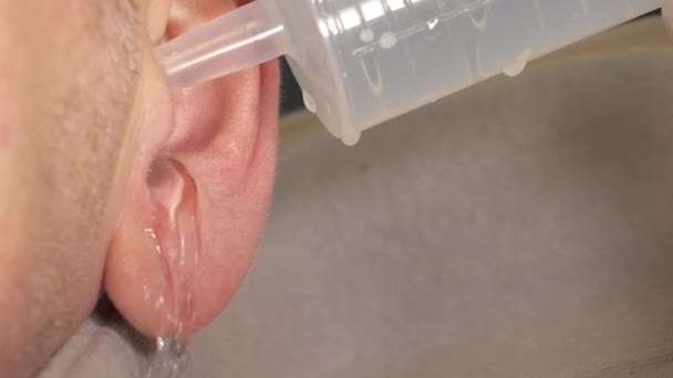 Tekutý propláchnutí vnitřní straně ucha muže - Záběry, video