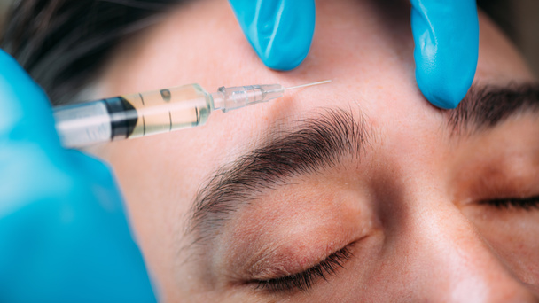 Dermale Filler Injection Gesichtsbehandlung. Anti-Aging-Konzept. - Foto, Bild