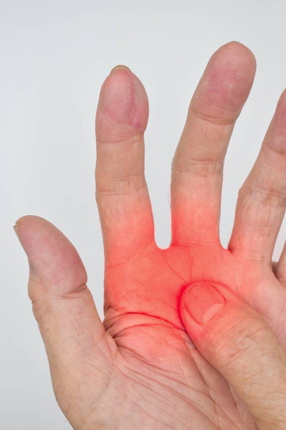 Bolesny aspekt dłoni azjatyckiego starca. Pojęcie zespołu ciasnoty przedziałów, zapalenia tkanki łącznej i bólu mięśni rąk. - Zdjęcie, obraz