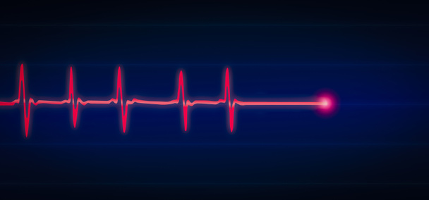 Patient monitor showing vital signs ECG and EKG. Vector illustration. - Photo, Image