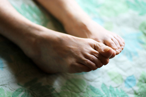 Lähikuva jalat iäkkään naisen makaa hoitotyön olla - Valokuva, kuva