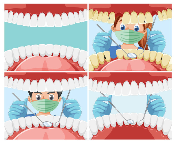 Set of dentist holding instruments examining patient teeth inside human mouth illustration - Vector, Image