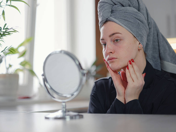 mujer sensación de shock mientras mira acné y cicatriz se producen en la cara - Foto, Imagen