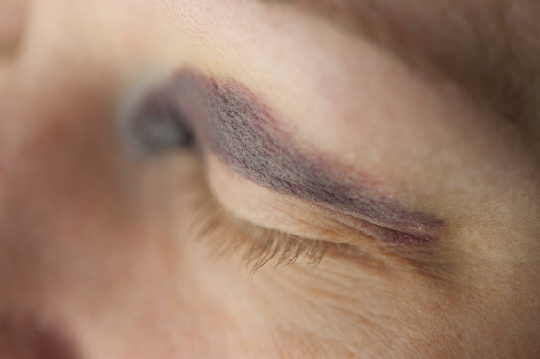 Eine Nahaufnahme auf das Auge einer schönen jungen Frau mit Blutergüssen unter dem Auge. Häusliche Gewalt Konzept mit Kopierraum  - Foto, Bild