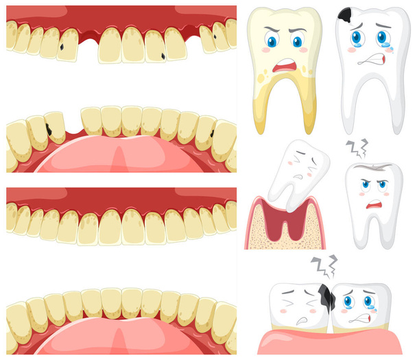 Набір всіх типів зубів на білому тлі ілюстрації
 - Вектор, зображення
