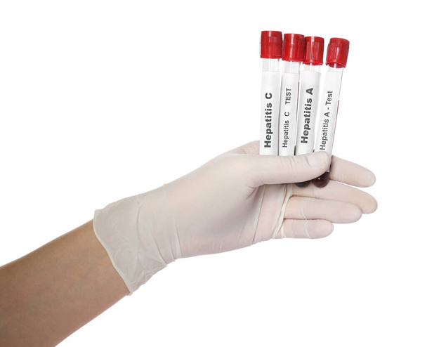 Scientist holding tubes with blood samples for hepatitis virus test on white background, closeup - Photo, image