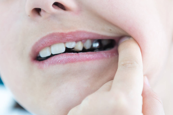 Retrato de niña linda muestra su aparato de ortodoncia sobre un fondo blanco
 - Foto, imagen