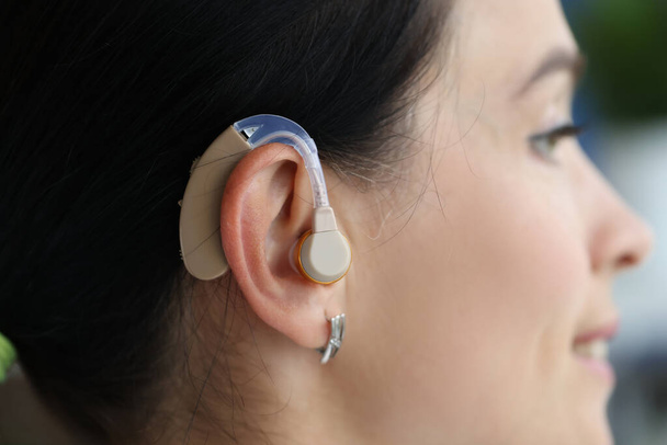 A hallókészülék a női fülön van. - Fotó, kép