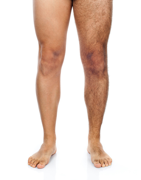 Mężczyzna Depilacja na nogi - Zdjęcie, obraz