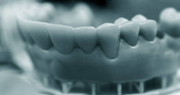 O homem da mandíbula inferior, criado em uma impressora 3d a partir de um fotopolímero - Foto, Imagem
