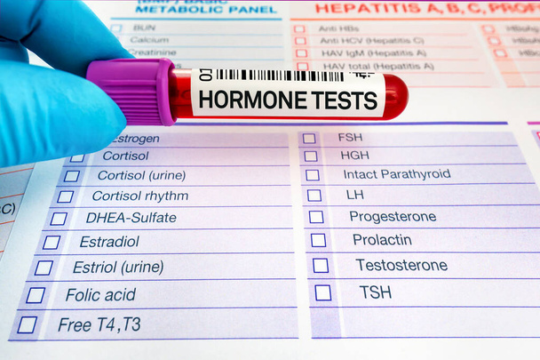 доктор проводит анализ гормонов в биохимической лаборатории. Образец крови для изучения уровня гормональных тестов - Фото, изображение