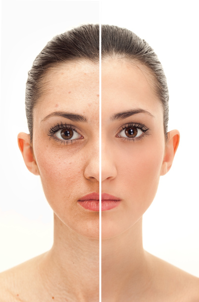 Концепция красоты до и после ретуши
 - Фото, изображение